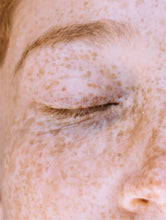 Lade das Bild in den Galerie-Viewer, Dark Spot Face Cream with Kojic Acid