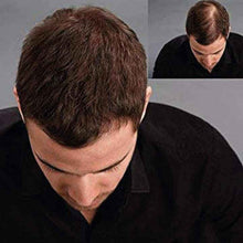 Lade das Bild in den Galerie-Viewer, KÖ-HAIR FIBERS 30g Haarverdichter, Streuhaar, Schütthaar
