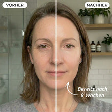 Lade das Bild in den Galerie-Viewer, LED Lichttherapie Maske
